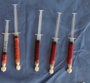 What is Platelet Rich Plasma