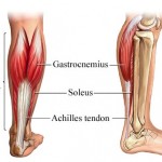 Achilles Tendon