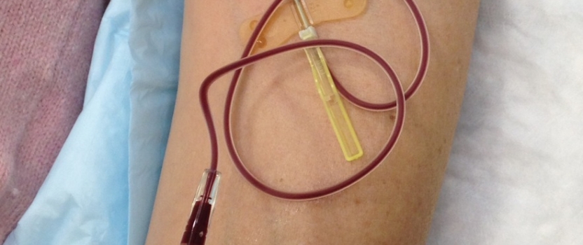 PRP and Joint Pain Improved
